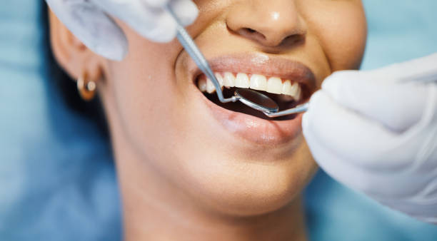 Best Emergency Treatment for Dental Infections or Abscesses in Woodmere, NY